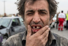 راهنمای دیه دندان