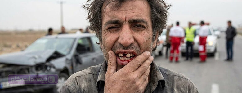 راهنمای دیه دندان